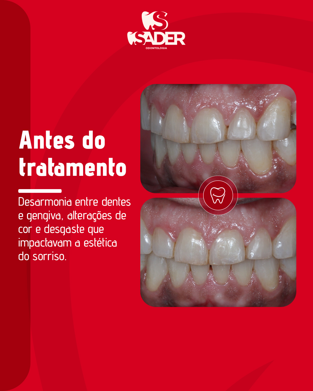 SADER-ODONTOLOGIA---CARROSSEL-(05-02)_01