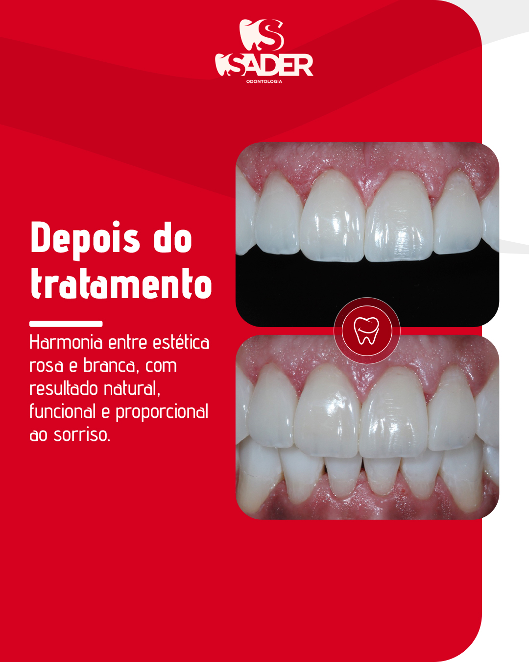 SADER-ODONTOLOGIA---CARROSSEL-(05-02)_02