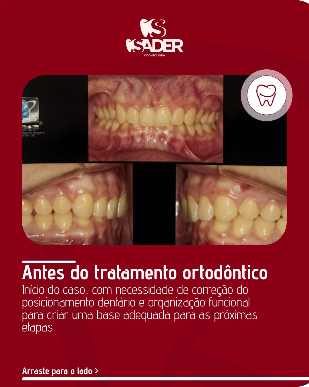 SADER_ODONTOLOGIA_-_CARROSSEL_(02-02)_01