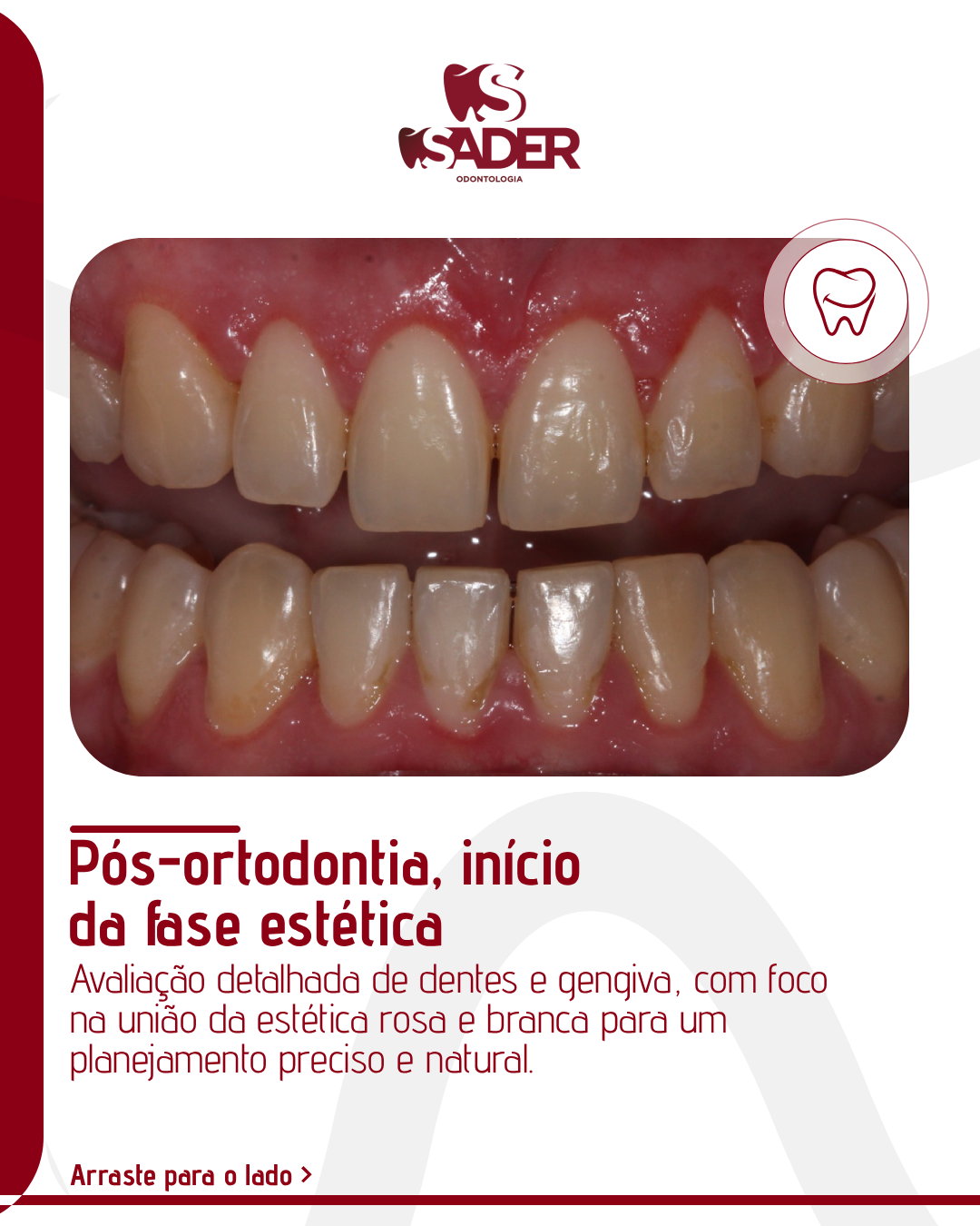 SADER_ODONTOLOGIA_-_CARROSSEL_(02-02)_02