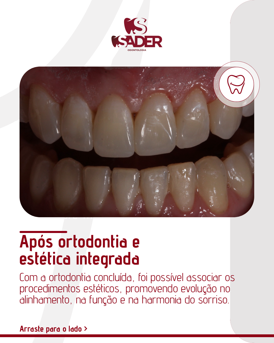 SADER_ODONTOLOGIA_-_CARROSSEL_(02-02)_03