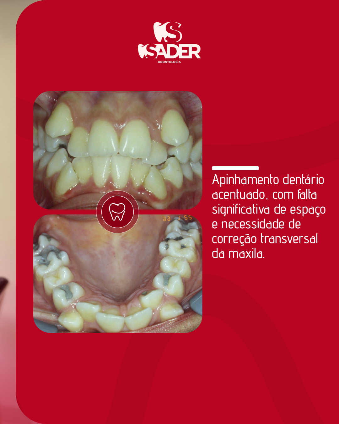 SADER_ODONTOLOGIA_-_CARROSSEL_(18-01)_02