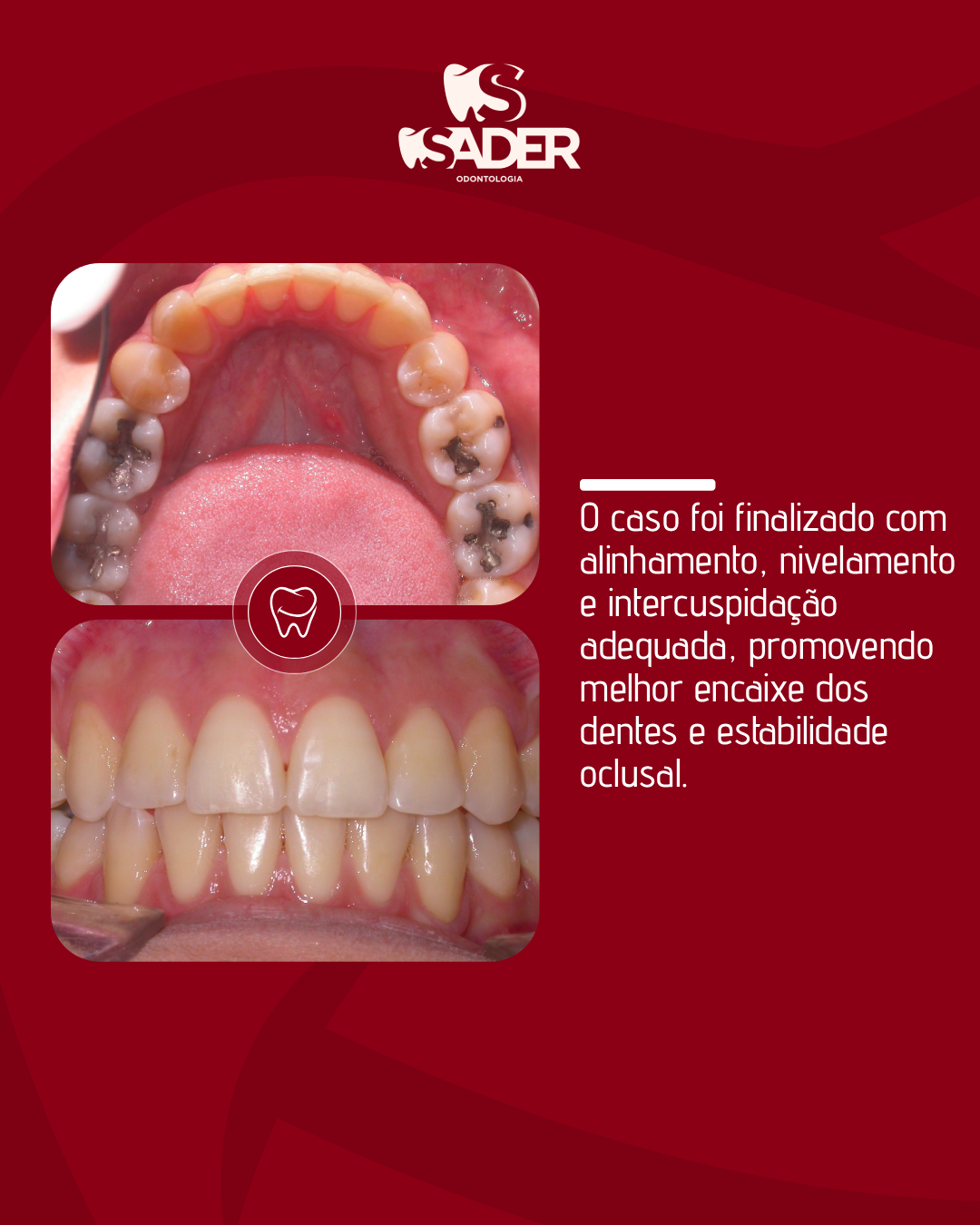 SADER_ODONTOLOGIA_-_CARROSSEL_(18-01)_04