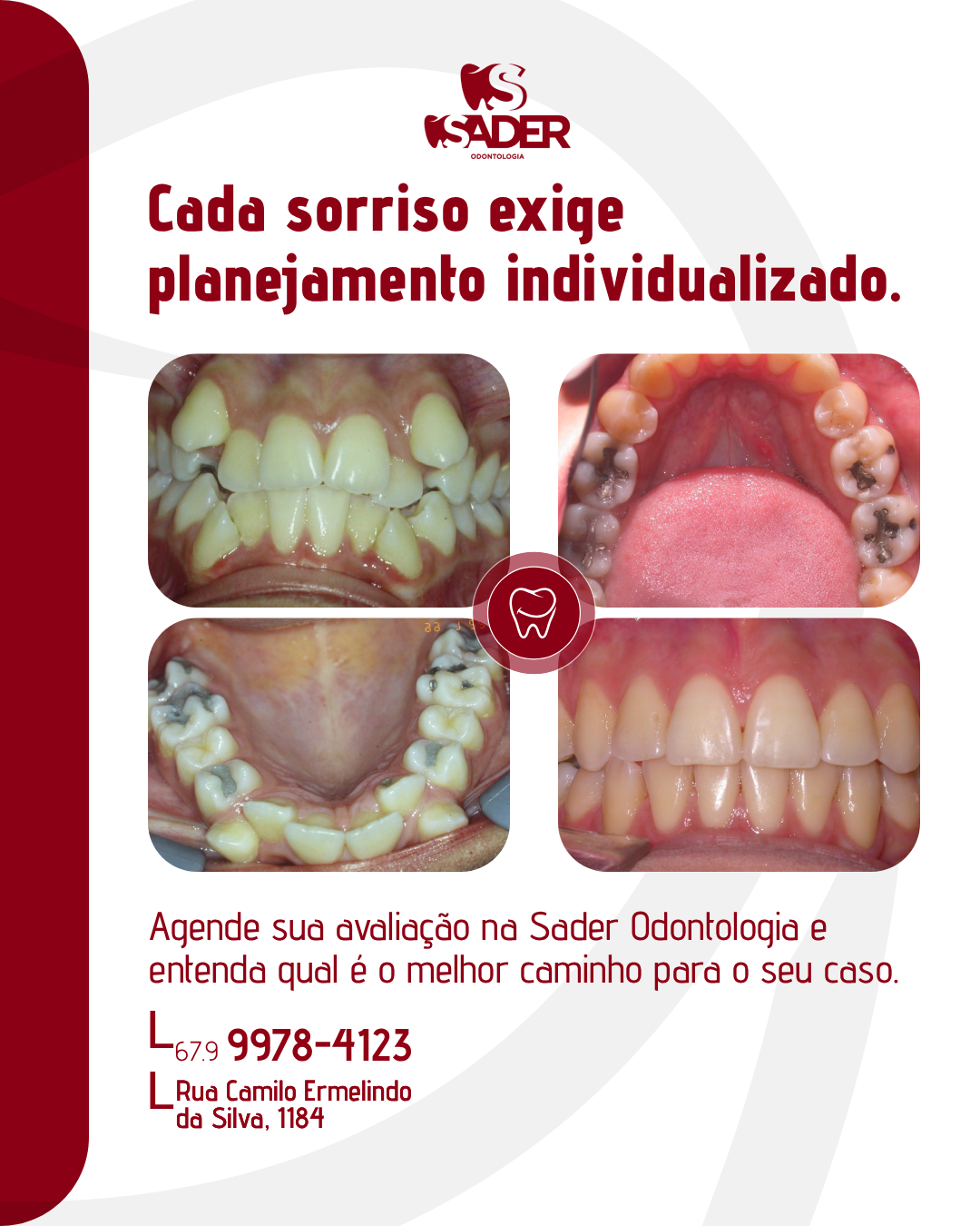 SADER_ODONTOLOGIA_-_CARROSSEL_(18-01)_05