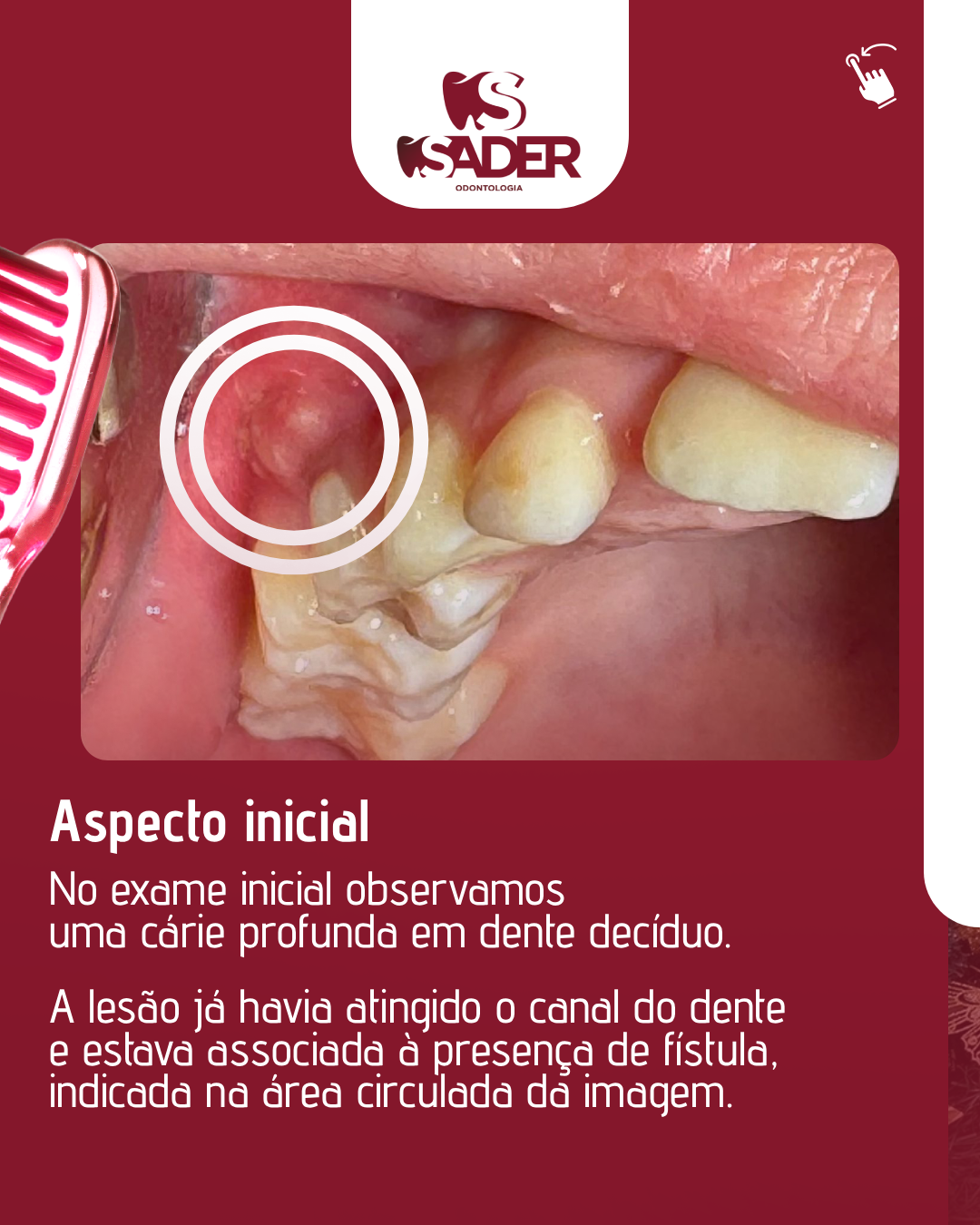 SADER_ODONTOLOGIA_-_CARROSSEL__(13-12)_02