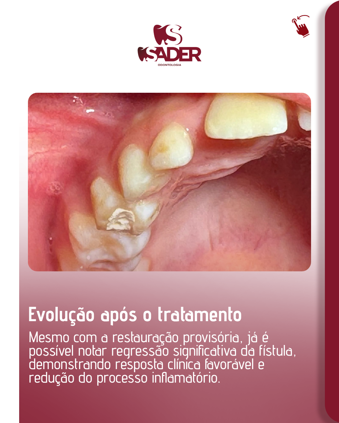 SADER_ODONTOLOGIA_-_CARROSSEL__(13-12)_04